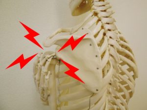 肩の脱臼や打撲の原因や症状とは？